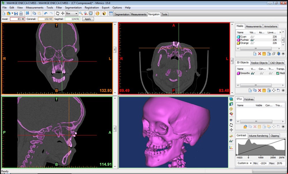 CUT plays pivotal role in innovative medical surgery