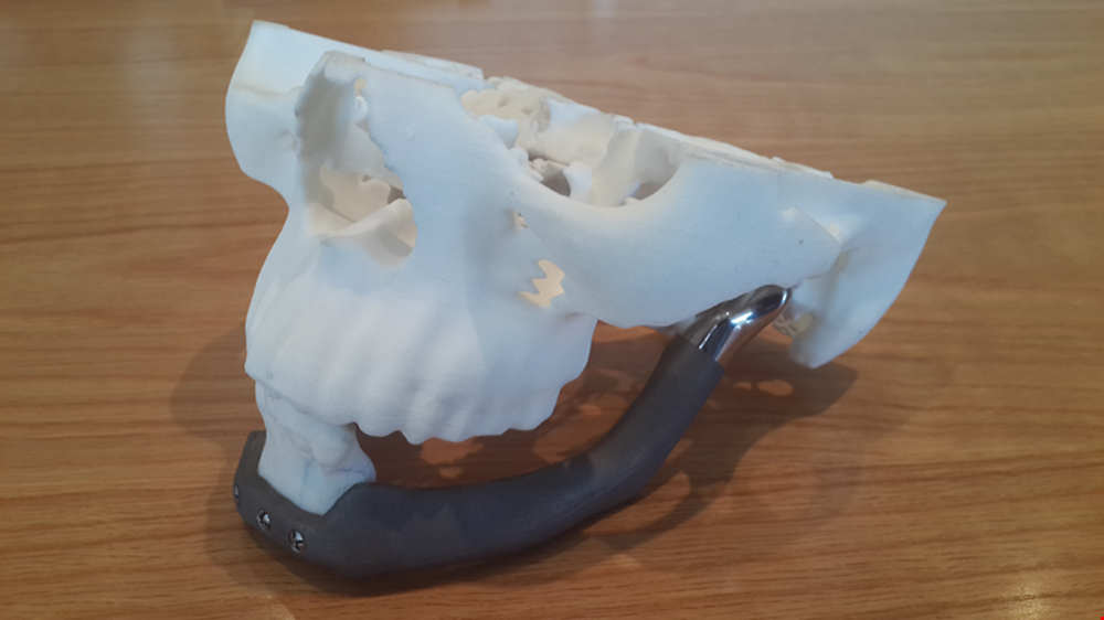 Medical Innovation in 3D Printing changed lives