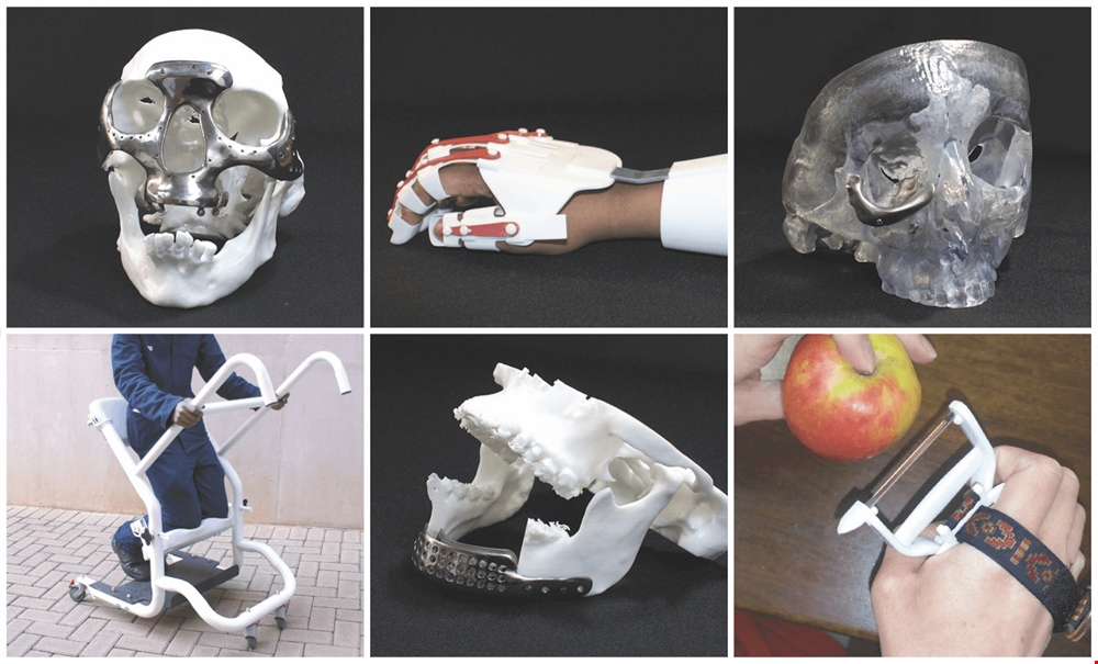 Innovative Healing: Central University of Technology’s Breakthrough in 3D Printed Medical Solutions