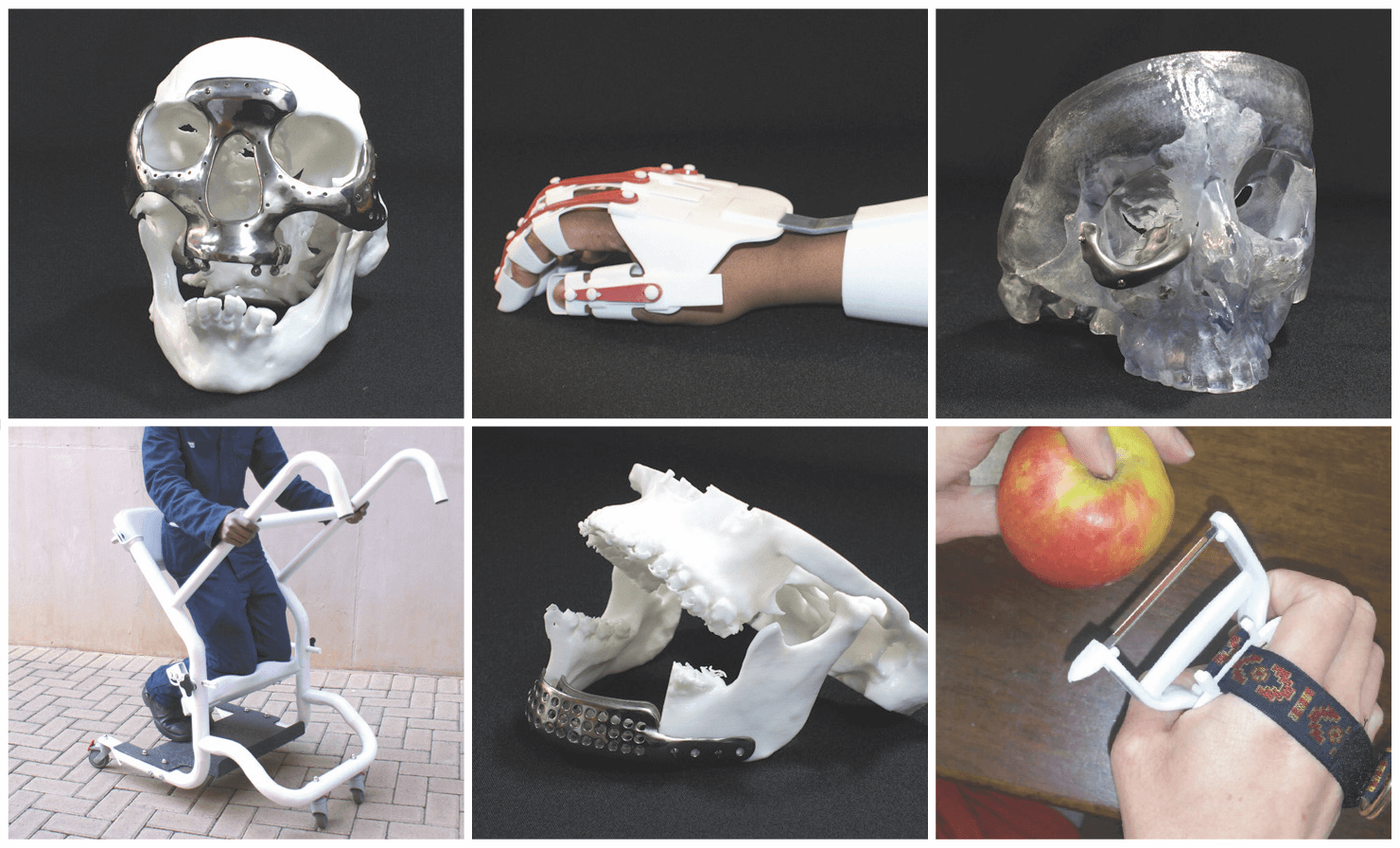 Innovative Healing: Central University of Technology’s Breakthrough in 3D Printed Medical Solutions Innovative Healing: Central University of Technology’s Breakthrough in 3D Printed Medical Solutions