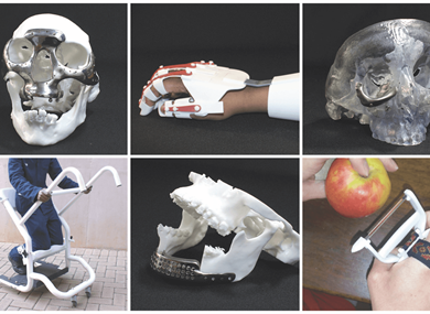 Innovative Healing: Central University of Technology’s Breakthrough in 3D Printed Medical Solutions