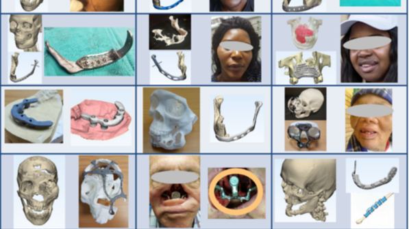 Changing Lives through 3D Printing